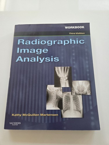 Radiographic image analysis - radiographic,