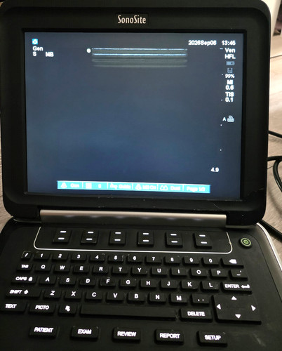 Sonosite edge ultrasound - sonosite,