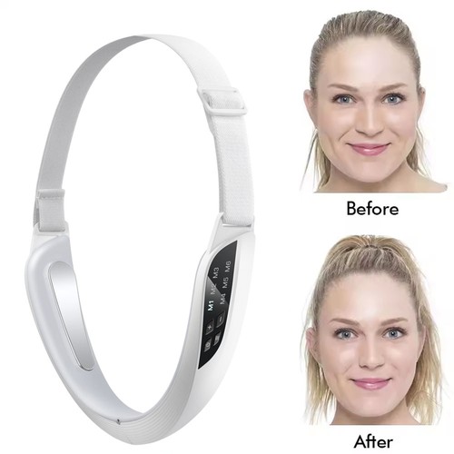 Electric face shaping - electric, v-face
