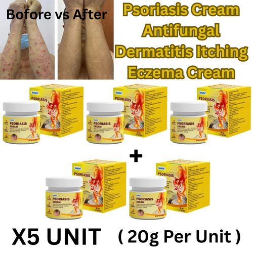 20g psoriasis cream - 20g,