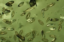 Watson Antique Microscope Slide. Surirella Gemma In Realgar