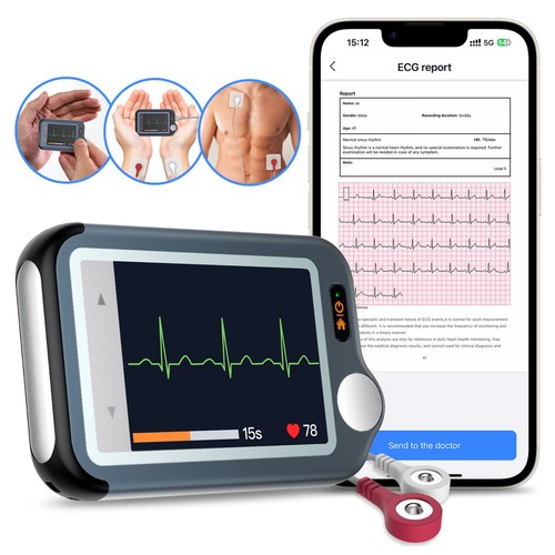 Mobile ecg ekg heart monitor - monitor,