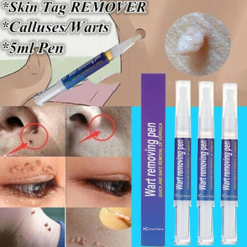 3packs hours wart remover - 12,