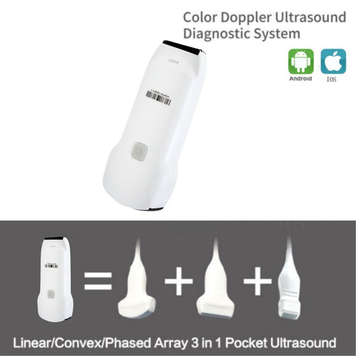 Wireless ultrasound - 3, 1