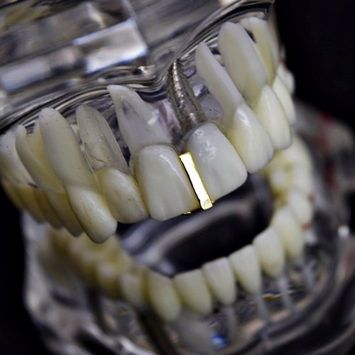 Gap grillz 14k - grillz,