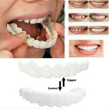 Snap On False Teeth Upper