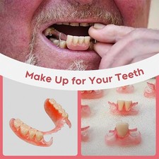 DIY Denture Fake Teeth-Full or Partial Denture Repair Missing Teeth Set UK~