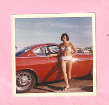 PHOTO - WOMAN BARE LEGS