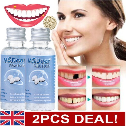 Temporary tooth repair - kit, fix