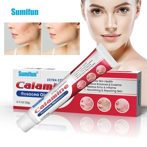 New rosacea ointment treat red - rosacea,