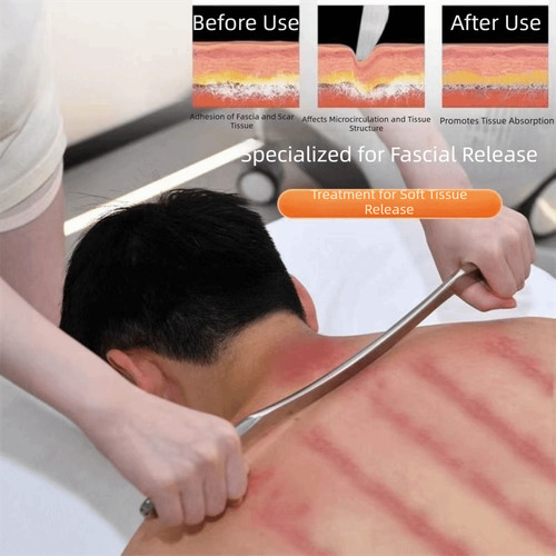 Gua sha scraping massage - gua,