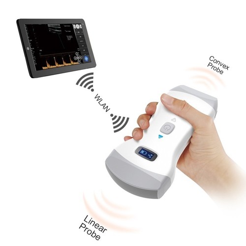 Wireless ultrasound scanner - wireless,