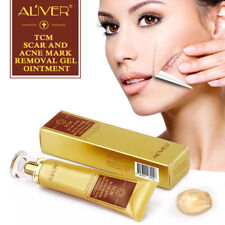 ALIVER Acne Scar Removal Cream Gel Ointment Stretch Cut Burn Spot Mark Treatment