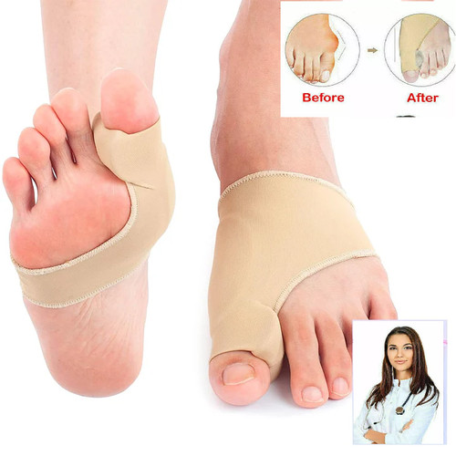 Big toe bunion - 2x, splint
