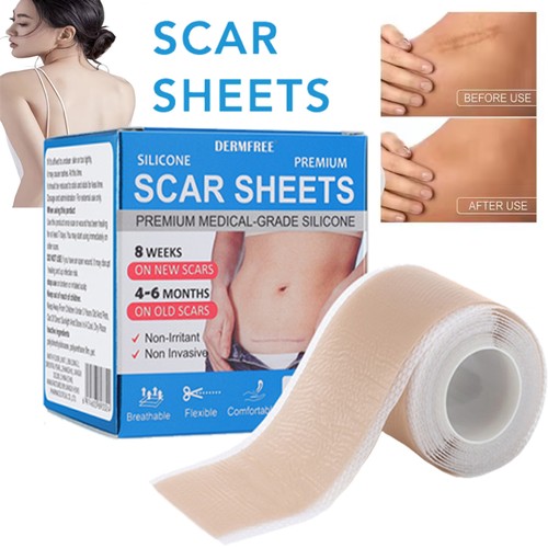 Medical grade scar - medical, removal