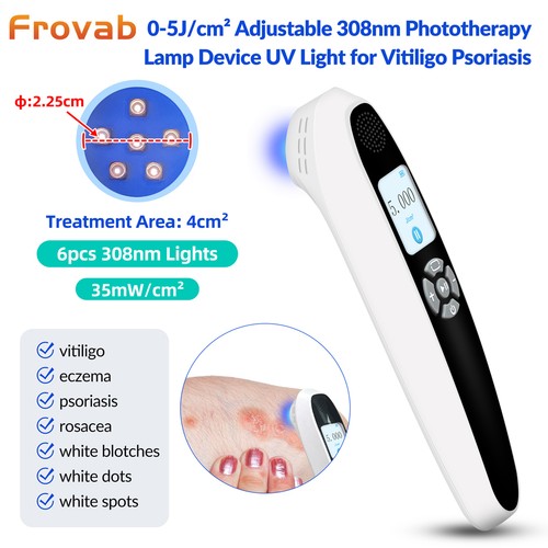 Handheld 308nm narrowband uvb - narrowband,