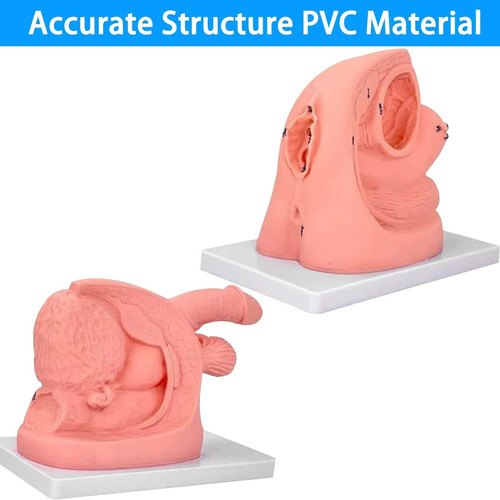 Male female urethral - female,