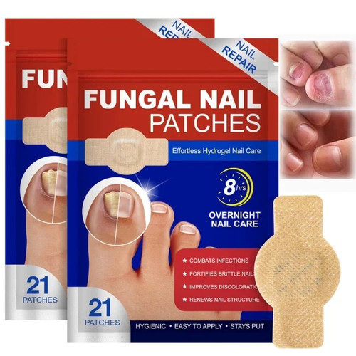 Fungal nail patches toe - fungal,