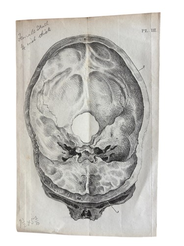 19thc lithograph female skull - female,
