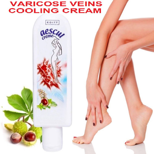 Spider veins varicose horse - veins,