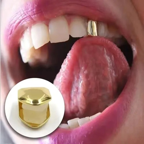 Tooth cap gold plated single - gold,