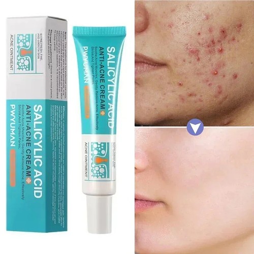 Salicylic acid strong - salicylic,