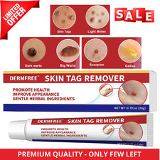 STRONG SKIN TAG REMOVER Cream