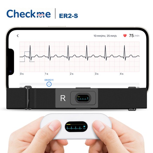 Checkme er2 mobile ecg ekg - ecg,