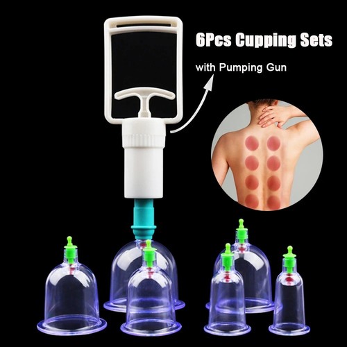 6pcs vacuum cupping sets - sets, with