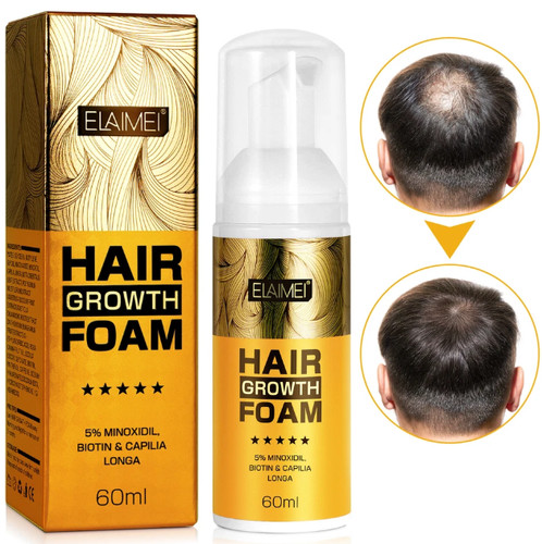 Minoxidil hair regrowth - hair,