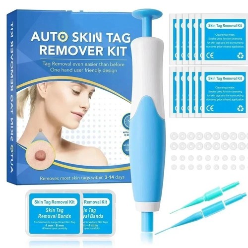 Skin tag removal - skin,