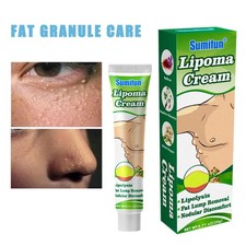 Lipomas Cream Antibacterial Cleansing Cellulite Fat Hot~ Removal20g Lump X1Y2