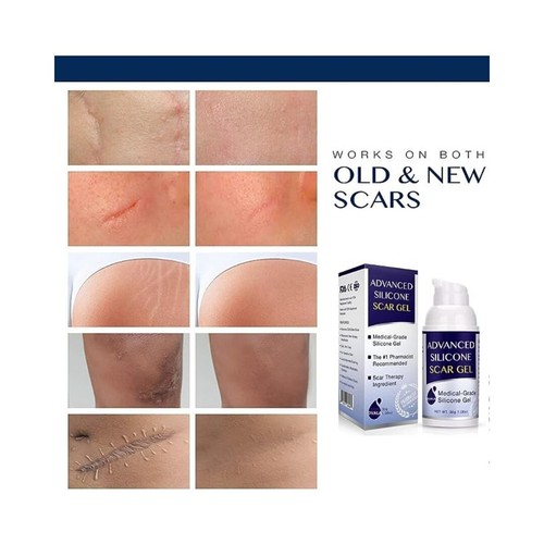 Silicone scar gel - silicone,