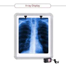 LED X-Ray Film Viewer Box SMALL (14''X17'') LARGE with free shipping