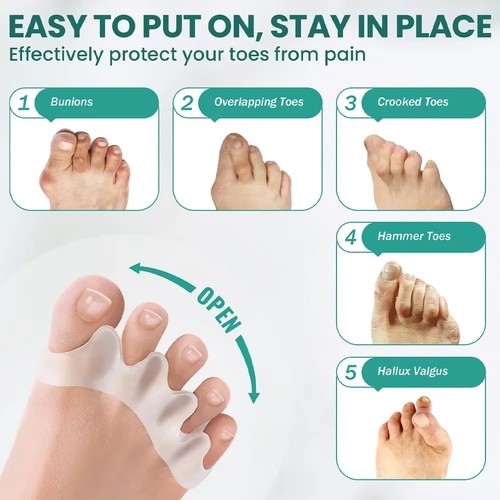 Bunion correction hammer - bunion,