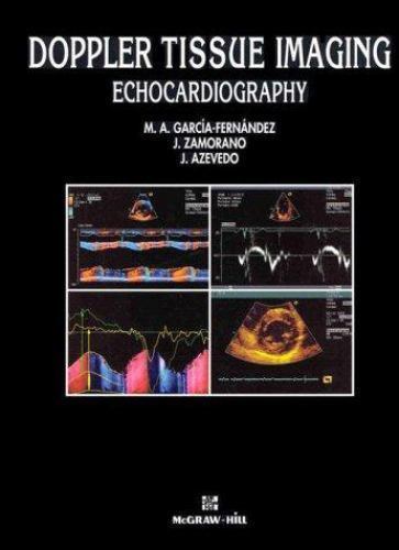 Doppler tissue imaging - doppler,