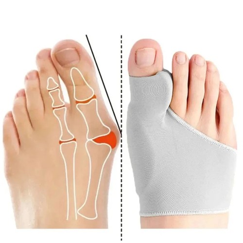 Bunion corrector hallux - 2x-bunion,