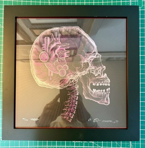 Emek ray framed - x-ray, 12x12