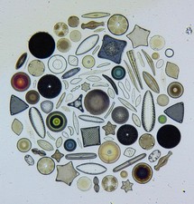 Vintage microscope slides by Klaus Kemp. "Diatom Exhibition Circle 100 forms".