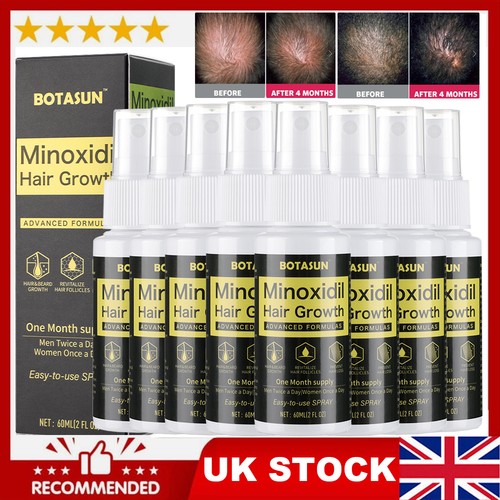 Minoxidil hair regrowth - hair,