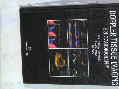 Doppler tissue imaging - doppler,