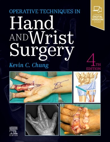 Operative techniques hand - techniques, &