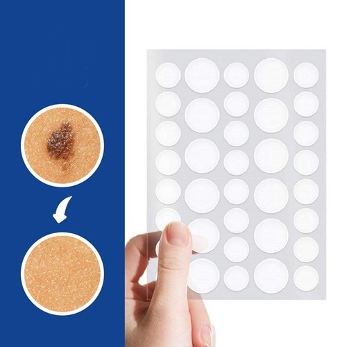 Skin tag remover patches - skin,