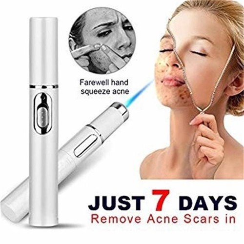 Blue light therapy acne - light, laser