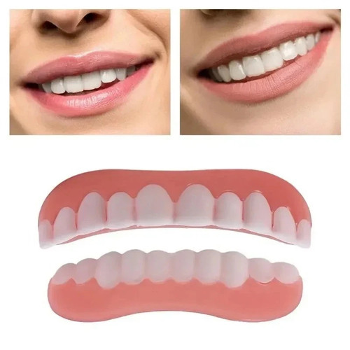 Smile snap false teeth - snap,