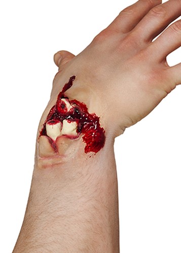 Stick broken wrist wound - on,