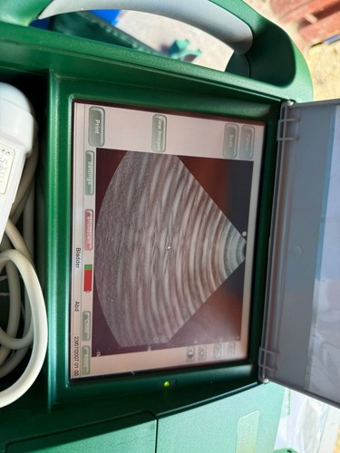 Bardscan iis ultrasound - bardscan,