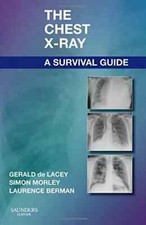 The Chest X-Ray: A Survival