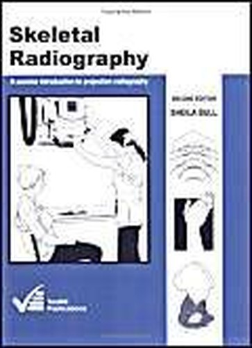 Skeletal radiography a - skeletal, radiography: