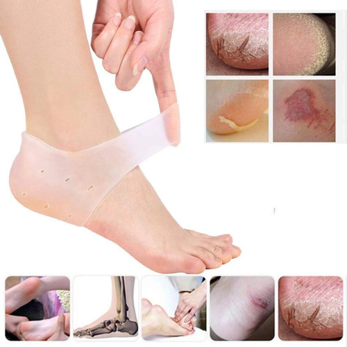 Silicone gel heel sleeves - 2x,